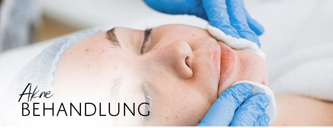 Akne Behandlung