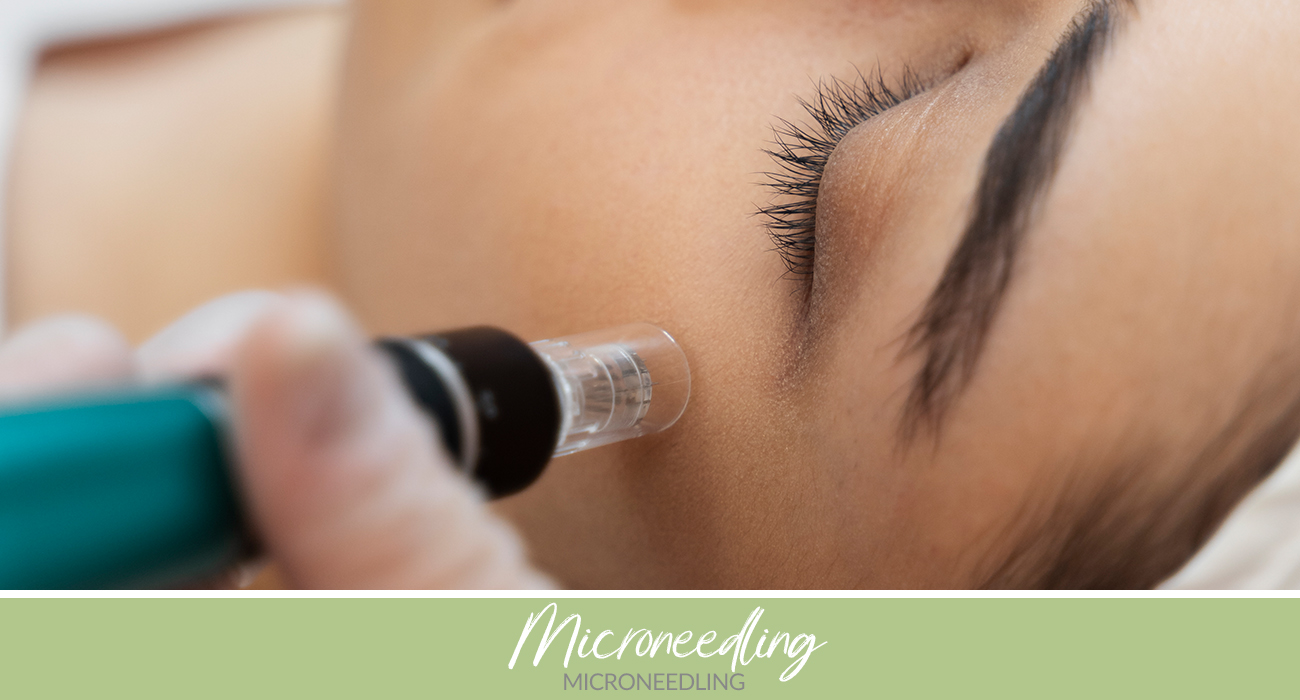 Microneedling