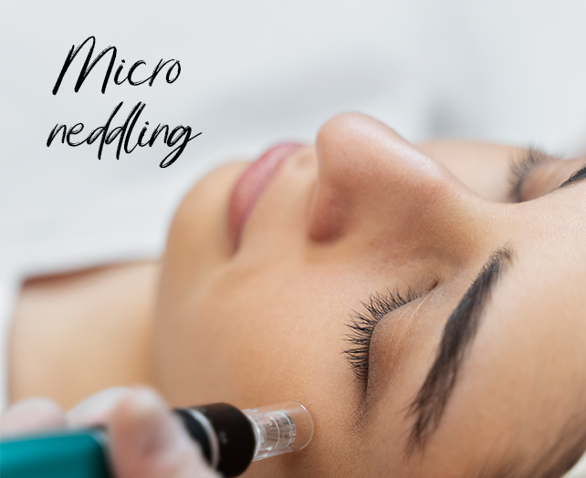 Microneedling